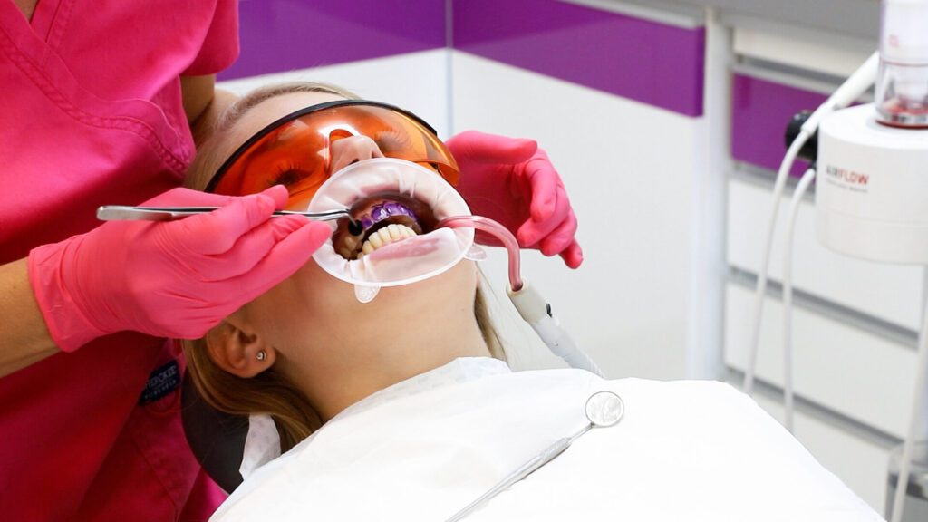 fogkő eltávolítás házilag lehetséges?