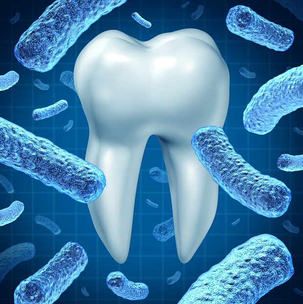 fogak_bakterium Dentálhigiénia, a professzionális fogtisztítás - Interjú Zsiga Mónikával